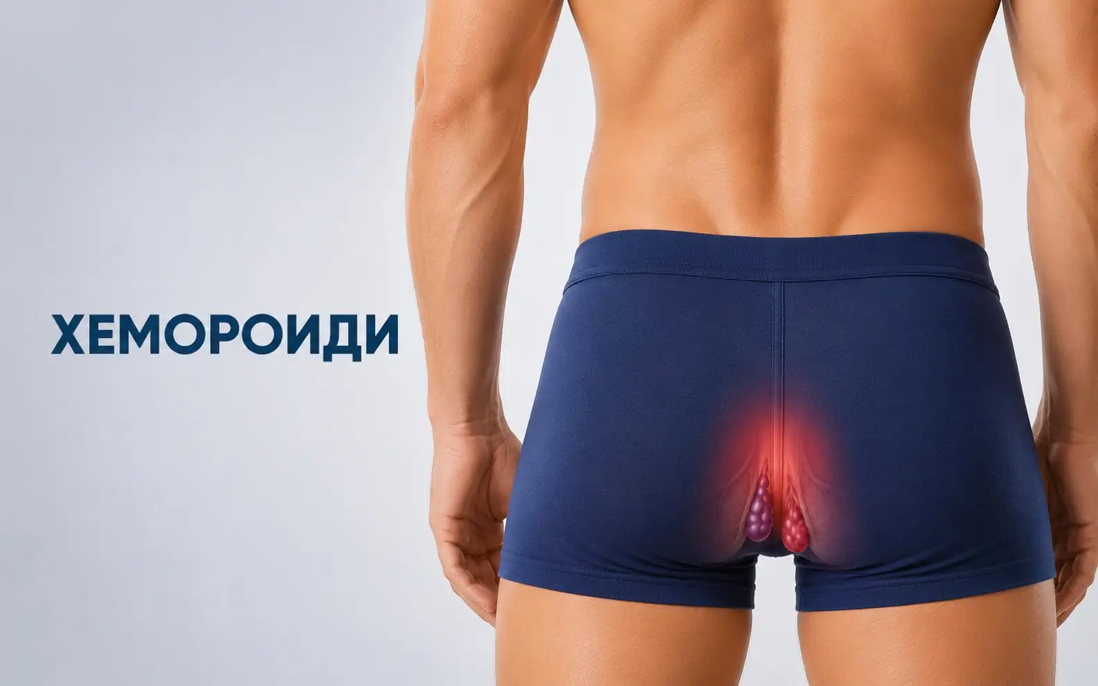 Хемороиди - диагностика и лечение